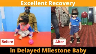 very good recovery in delayed milestone child! delayed milestone