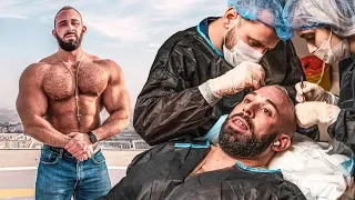 Meine Haartransplantation in der Türkei! War das wirklich eine gute Idee?