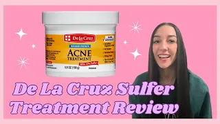 De La Cruz Sulfur Treatment for Acne DOES IT WORK? My HONEST review..