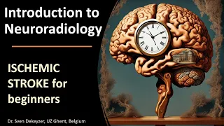 Imaging of Acute Ischemic Stroke: the basics!