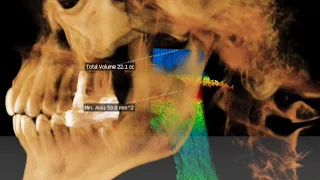 Why do dentists use a 3d CBCT x-ray