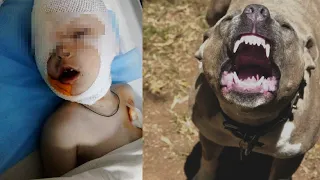 Понівечене обличчя та тіло. У Кропивницькому собака напав на 5-річного хлопчика | CBN