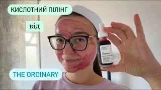 КРОВАВИЙ ПІЛІНГ The Ordinary: правила використання.