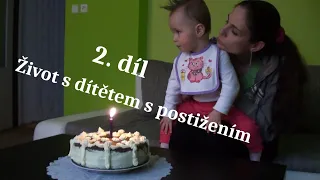 Život s dítětem s postižením /2. díl - porod a první rok/