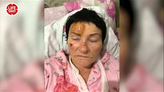 Пожилую женщину избили пьяные гопники на Кубани в станице Смоленская