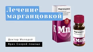 Лечение марганцовкой: мнение врачей