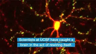 Scientists Catch Brain Circuits in the Act of Rewiring