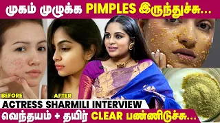 Sun Tan-கு Coffee & Sugar Scrub போடுவேன் - Ponni Serial Actress Shiyara Sharmi Interview