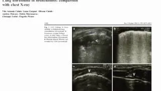 Ultrasound Podcast - Lung Ultrasound with Vicki Noble - Part 2