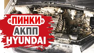 Один из способов устранения рывков при переключении АКПП Hyundai (Хендай)