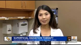 Superficial Radiation Therapy for Skin Cancer