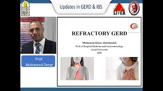 Refractory GERD | By Prof. Mohamed Omar