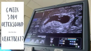 1st Baby | 2nd Ultrasound 6w3d | Heartbeat? | Becoming a Single Mom by Choice