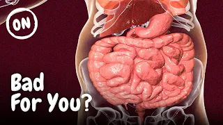 Top 5 Worst Foods for Your Gut