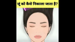 माथे के जूं को कैसे हटाते हैं🤔– How to Remove head Lice #shorts #youtubeshorts #satisfyingvideo