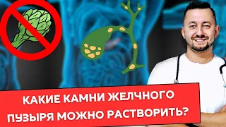 Растворение КАМНЕЙ в желчном пузыре