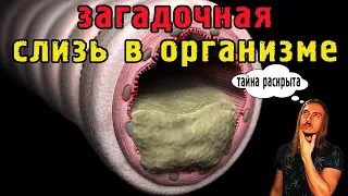 Загадочная слизь из кишечника под микроскопом | Гной и воспаления откуда берутся в нашем организме