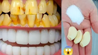 सिर्फ 3 मिनट में गंदे पीले दाँतो को मोतियों जैसा सफेद चमकदार बना देगा | teeth whitening | dant safed