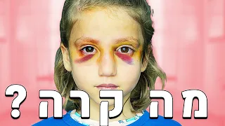 הפציעה של הבן שלי