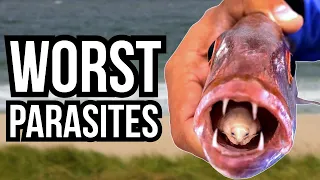 3 Of The Worst Parasites In The World - NIGHTMARE FUEL