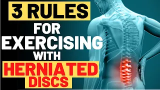 Exercising With Herniated Disc - 3 MUST FOLLOW Rules for exercising with herniated discs 2020