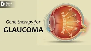 Gene therapy for glaucoma : Effective & Procedure - Dr. Sunita Rana Agarwal