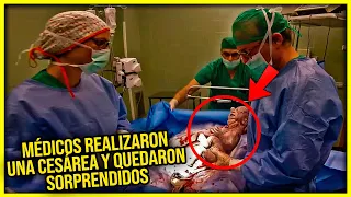 Cuando los MÉDICOS realizaron una CESÁREA y vieron al BEBE quedaron sorprendidos😱