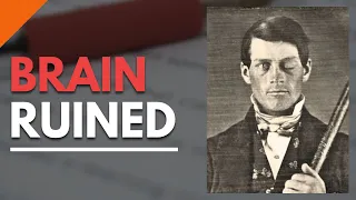 Vomiting Up Brain? The Gruesome Story of Phineas Gage