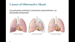 PEC Chapter 15 Shock and Resuscitation