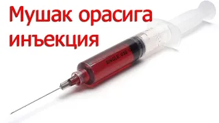 #2. Мушак орасига инъекция қоидалари