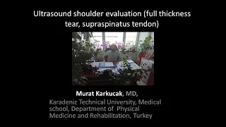 Ultrasound shoulder evaluation (full thickness tear, supraspinatus tendon), by Prof Murat Karkucak