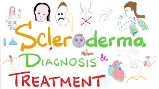 Scleroderma Diagnosis and Management