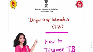 Diagnosis of Tuberculosis