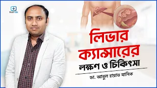 লিভার ক্যান্সারের লক্ষণ ও চিকিৎসা কি? #livercancertreatment