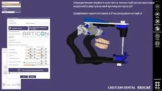 Виртуальный Артикулятор: Определение первого контакта в ЦС - цифровой протокол