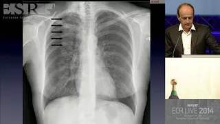 Chest - Common and uncommon errors in plain film and CT imaging of the chest   how to improv