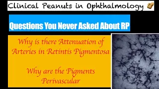 Clinical Peanuts 🥜 : why do we see Bony spicule pigments in Retinitis pigmentosa