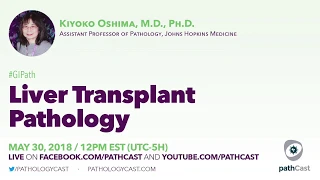 Liver transplant pathology - Dr. Oshima (Johns Hopkins) #GIpath