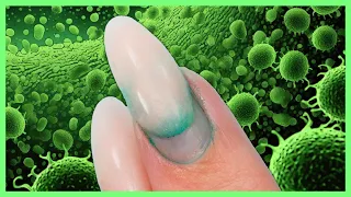 Watch For Hidden Bacteria/Greenies In Your Nails