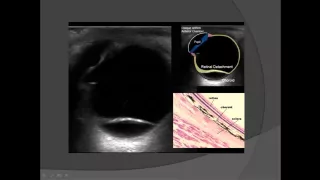 EM Ocular Ultrasound Podcast