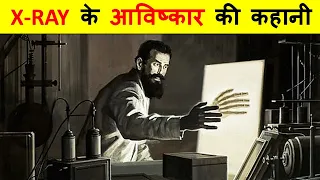 X-Ray का आविष्कार कब और किसने किया ? COMPLETE HISTORY OF THE INVENTION OF X-RAY.