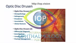 Optic Disc Drusen Part 1 Preview