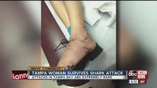 tampa woman survives shark attack