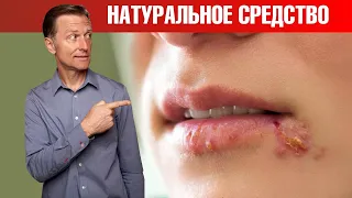 Герпес на губах? Эти 3 средства мгновенно избавят от герпеса🧐