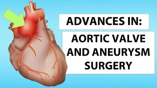 Patient Webinar: Advances in Aortic Valve & Aneurysm Surgery with Dr. Bavaria and Dr. Desai