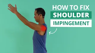 SHOULDER IMPINGEMENT: 8 Exercises and Strategies to Treat it For Good