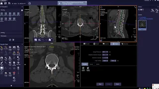 ct disk ازاى اعمل ديسكات للفقرات