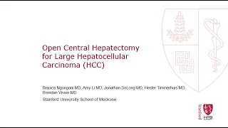 Open Central Hepatectomy for Large Hepatocellular Carcinoma