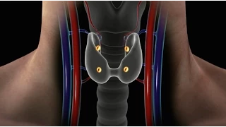Overview of Parathyroid Disease (Causes, Symptoms and Treatment for Hyperparathyroidism)