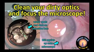 clean your dirty optics and focus the microscope for cataract surgery